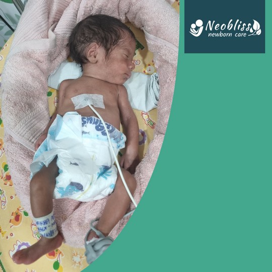 Patient Success Story - Baby Adhav 1