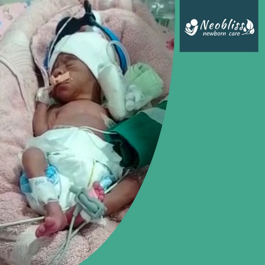 Patient Success Story - Baby Adhav 3