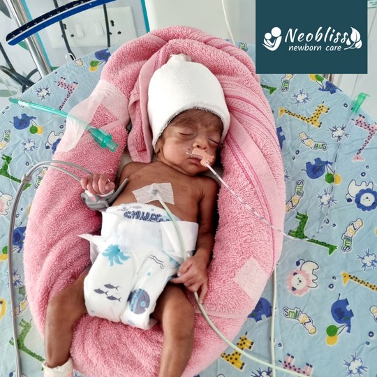 Patient Success Story - Baby Srivika